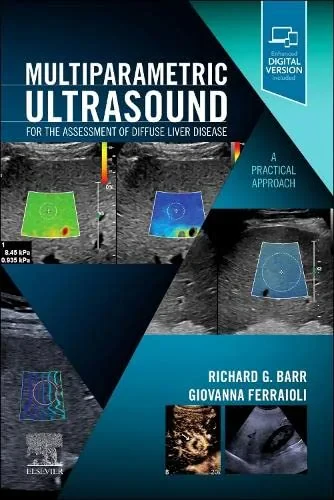 Coperta cărții "Multiparametric Ultrasound for the Assessment of Diffuse Liver Disease" de Richard G. Barr, Giovanna Ferraioli