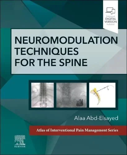 Coperta cărții "Neuromodulation Techniques for the Spine" de Alaa Abd-Elsayed