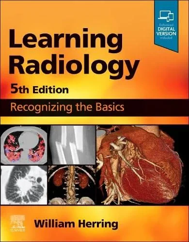 Coperta cărții "Learning Radiology: Recognizing the Basics" de William Herring