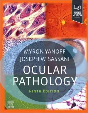 Coperta cărții "Ocular Pathology, 9th Edition" de Myron Yanoff, Joseph W. Sassani