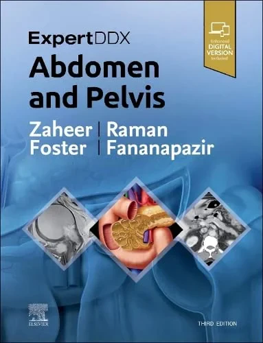 Coperta cărții "ExpertDDx: Abdomen and Pelvis " de Siva P Raman, Atif Zaheer, Bryan R. Foster, Ghaneh Fananapazir