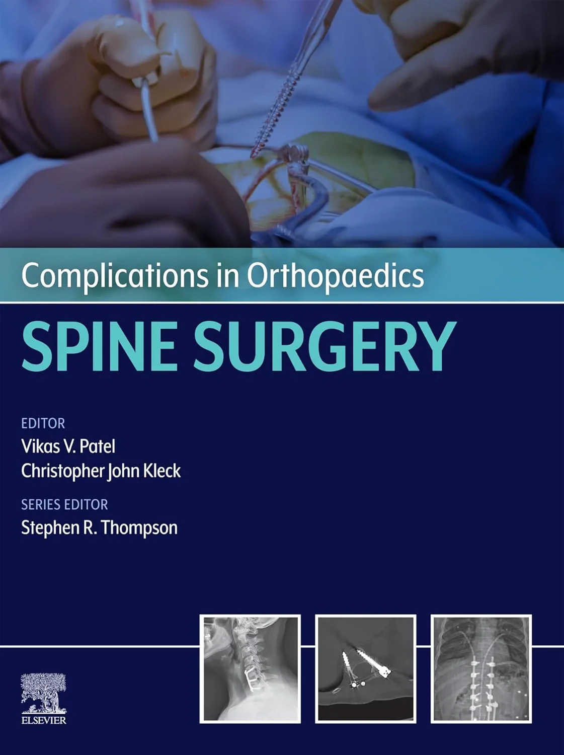 Coperta cărții "Complications in Orthopaedics: Spine Surgery" de Stephen Thompson, Vikas Patel, Christopher J. Kleck