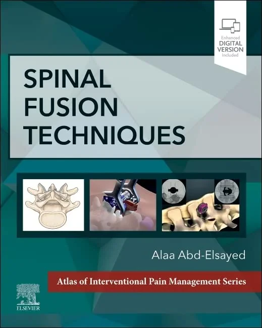 Coperta cărții "Spinal Fusion Techniques" de Alaa Abd-Elsayed