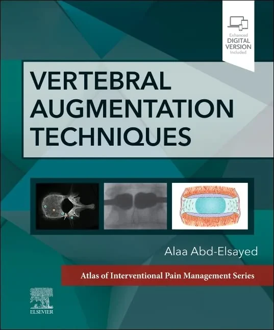 Coperta cărții "Vertebral Augmentation Techniques" de Alaa Abd-Elsayed