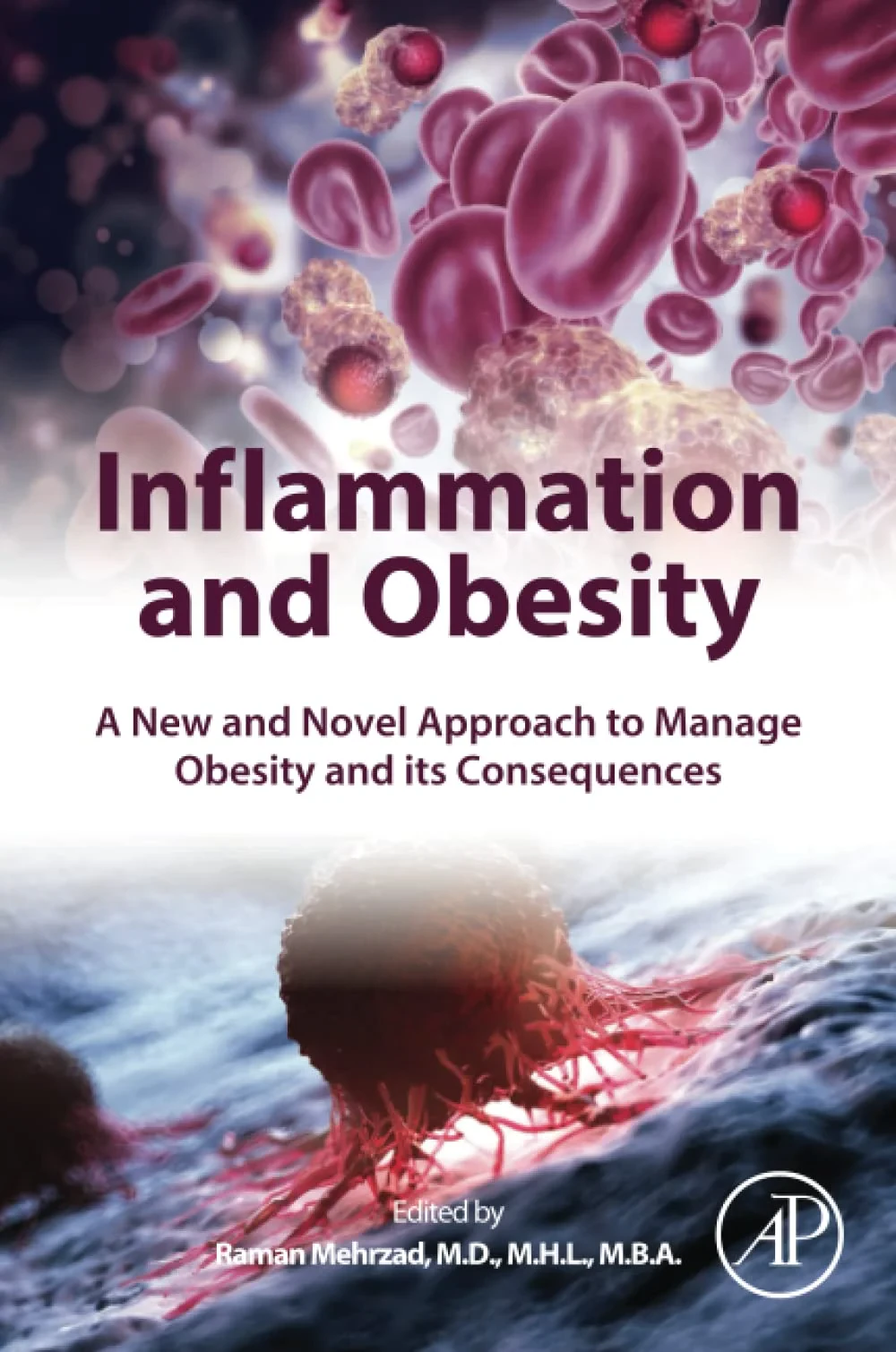 Coperta cărții "Inflammation and Obesity: A New and Novel Approach to Manage Obesity and its Consequences" de Mehrzad
