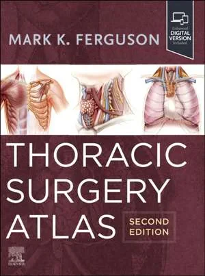 Coperta cărții "Thoracic Surgery Atlas" de Mark K. Ferguson