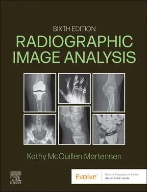 Coperta cărții "Radiographic Image Analysis" de Kathy McQuillen-Martensen