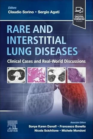 Coperta cărții "Rare and Interstitial Lung Diseases, 1st Edition" de Claudio Sorino &amp; Sergio Agati