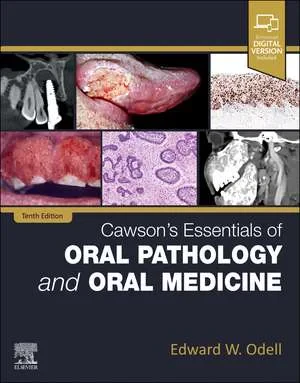 Coperta cărții "Cawson’s Essentials of Oral Pathology and Oral Medicine" de Edward W Odell