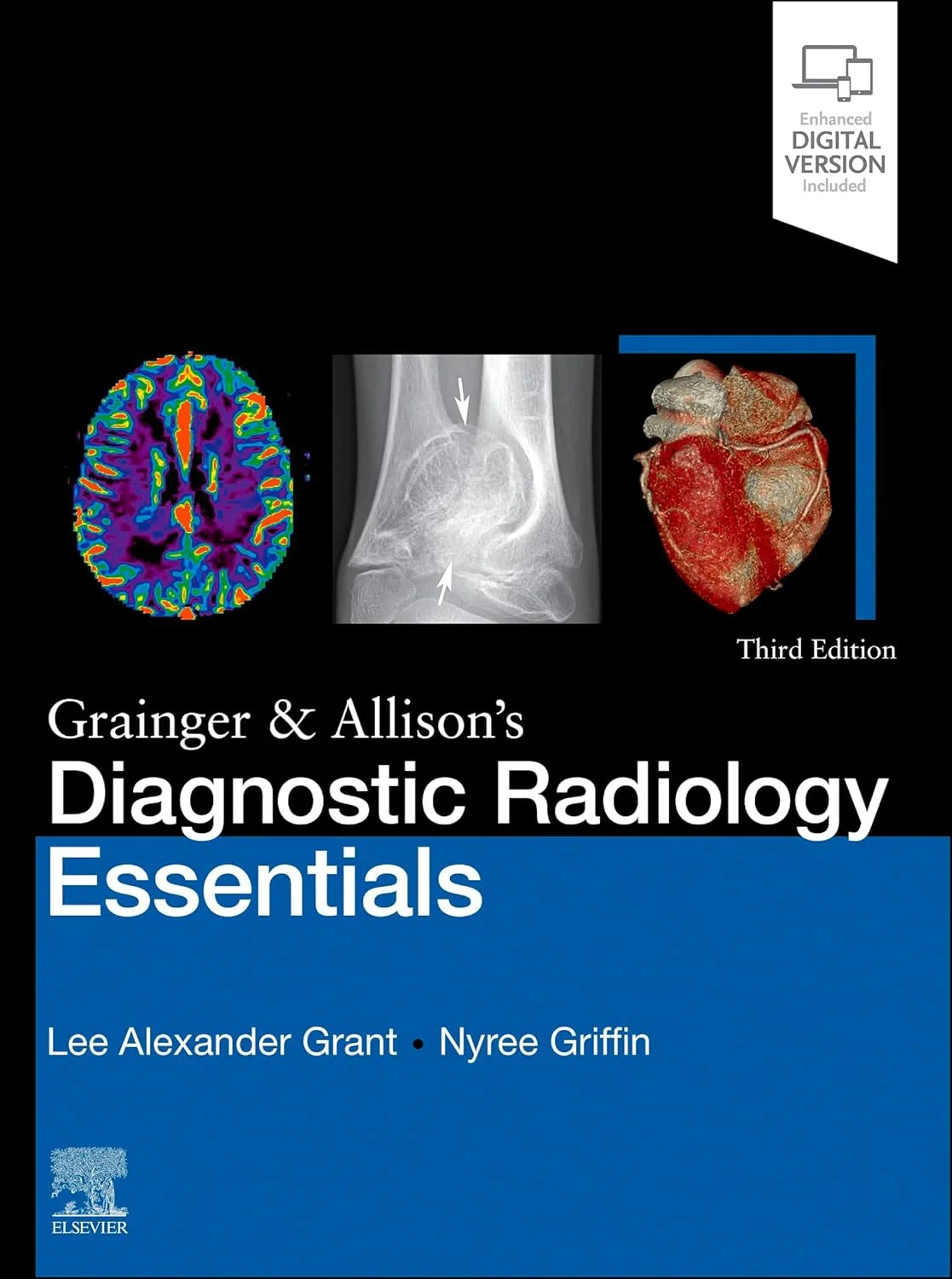 Coperta cărții "Grainger &amp; Allison’s Diagnostic Radiology Essentials " de Lee A. Grant, Nyree Griffin