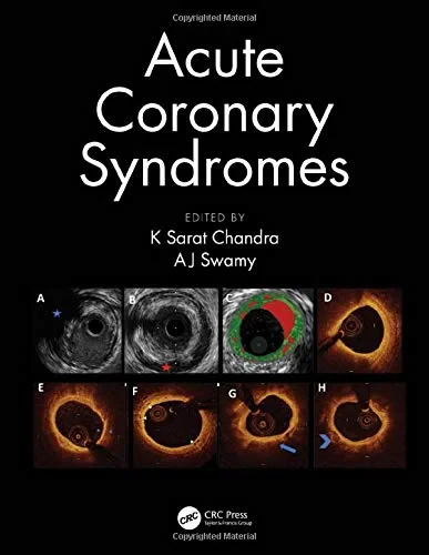 Coperta cărții "Acute Coronary Syndromes, 1st Edition" de K Sarat Chandra, AJ Swamy
