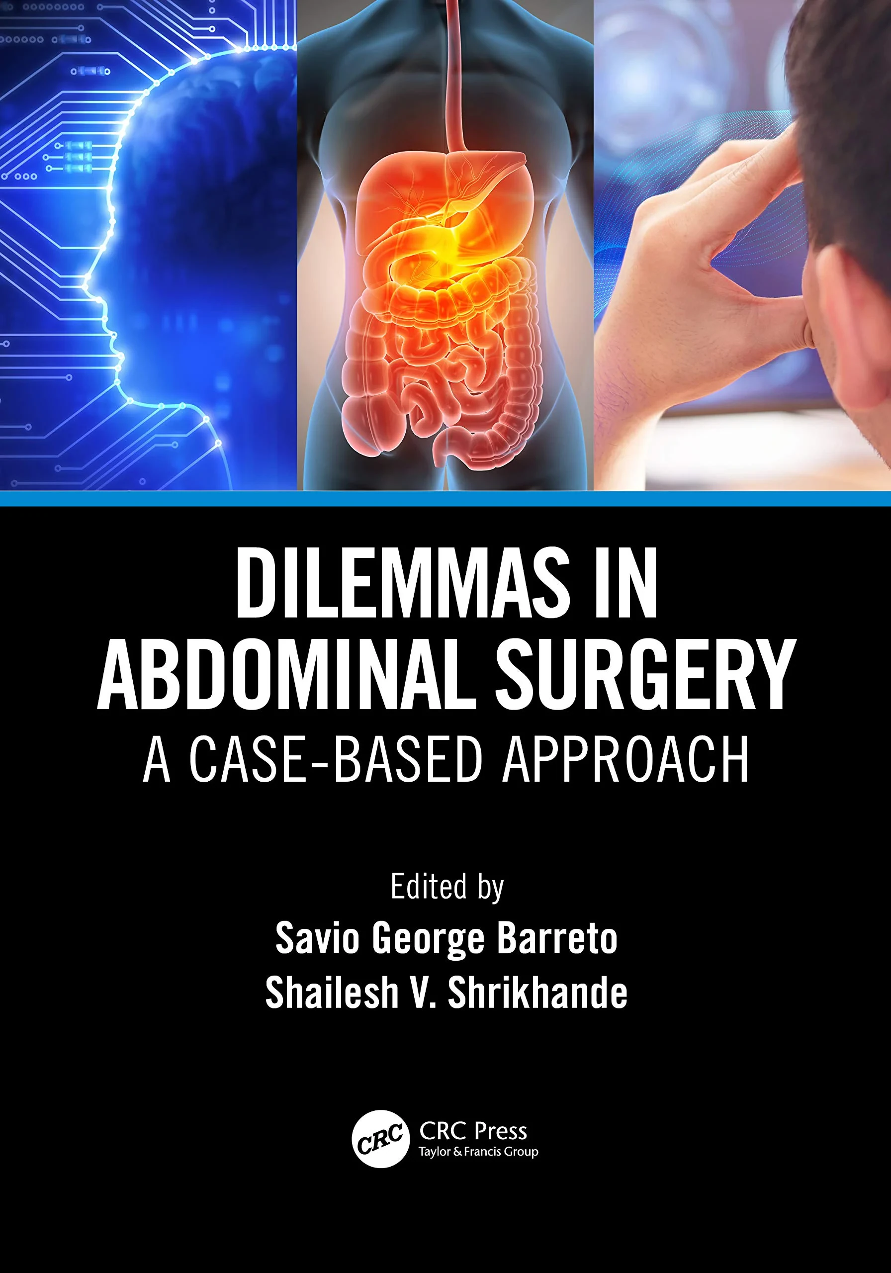 Coperta cărții "Dilemmas in Abdominal Surgery: A Case-Based Approach" de Savio George Alberto da Piedade Barreto, Shailesh Vinayak Shrikhande (