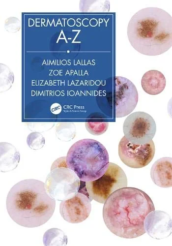 Coperta cărții "Dermatoscopy A-Z" de Aimilios Lallas, Zoe Apalla, Elizabeth Lazaridou, Dimitrios Ioannides