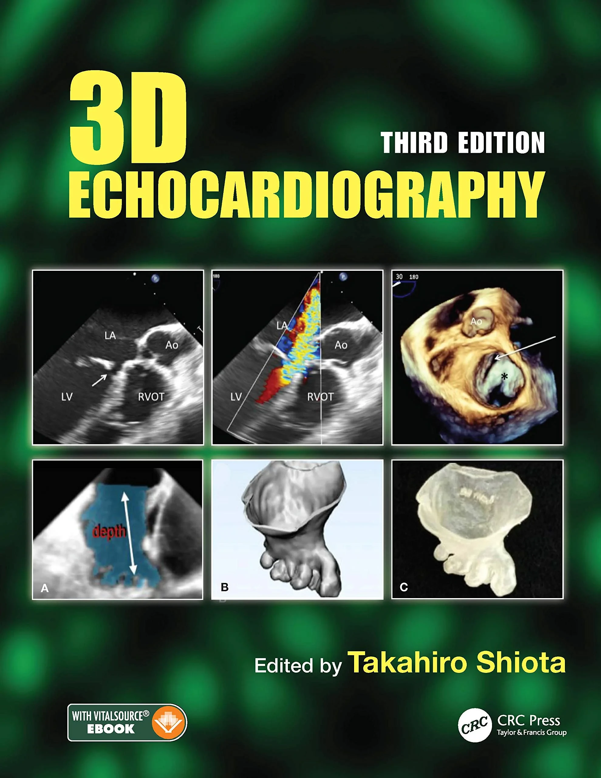 Coperta cărții "3D Echocardiography, 3rd Edition" de Takahiro Shiota