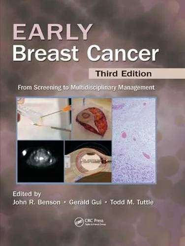 Coperta cărții "Early Breast Cancer. From Screening to Multidisciplinary Management, Third Edition" de John R Benson, Gerald P.H. Gui, Todd Tuttle