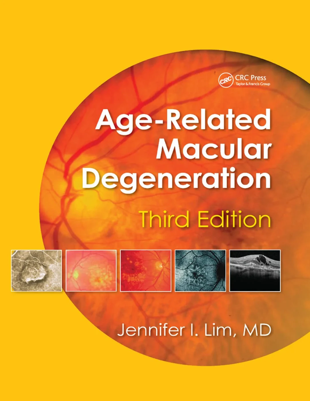 Coperta cărții "Age-Related Macular Degeneration" de Jennifer I. Lim