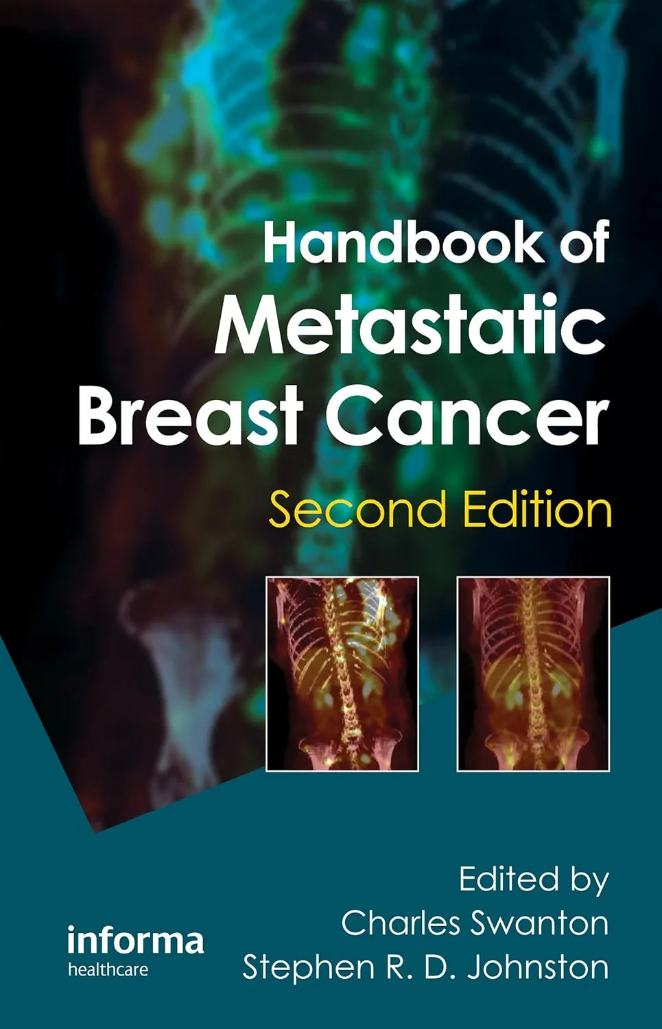 Coperta cărții "Handbook of Metastatic Breast Cancer" de Charles Swanton, Stephen R. D. Johnston