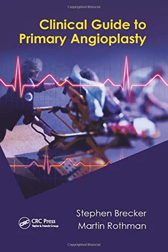 Coperta cărții "Clinical Guide to Primary Angioplasty 1st Edition" de Stephen Brecker