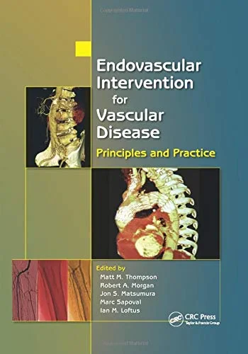 Coperta cărții "Endovascular Intervention for Vascular Disease" de Matt M. Thompson