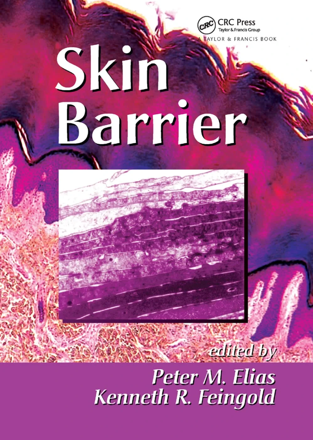 Coperta cărții "Skin Barrier" de Peter M. Elias, Kenneth R. Feingold