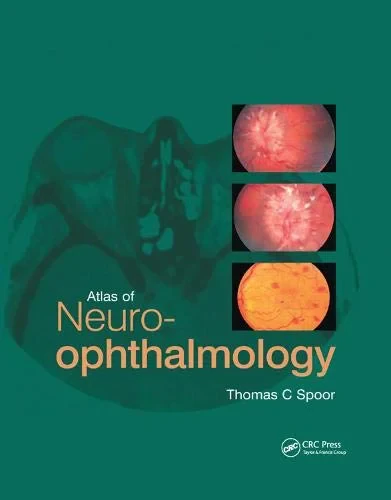 Coperta cărții "Atlas of Neuro-ophthalmology " de Thomas C. Spoor
