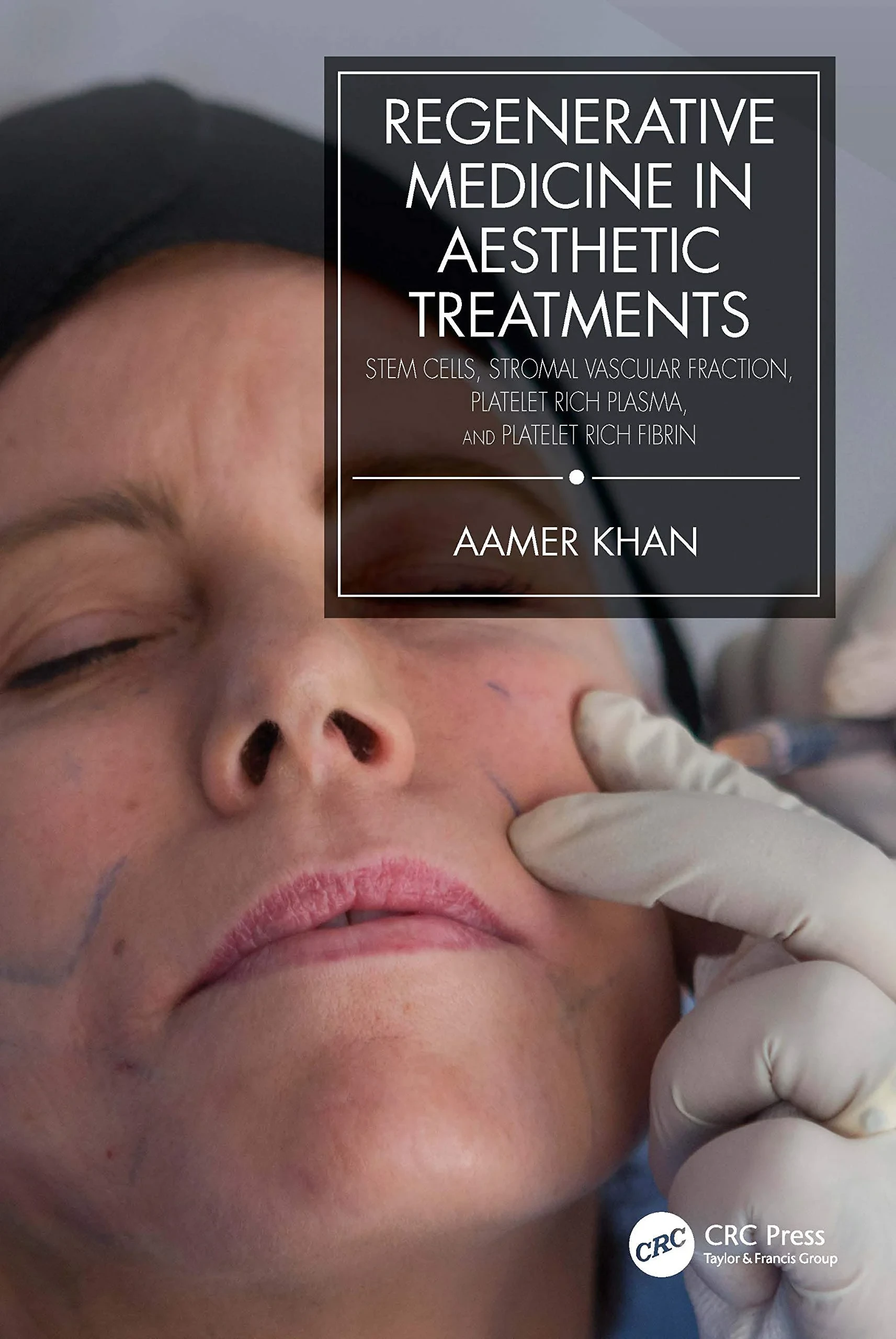 Coperta cărții "Regenerative Medicine in Aesthetic Treatments: Stem Cells, Stromal Vascular Fraction, Platelet Rich Plasma, and Platelet Rich Fibrin" de Aamer Khan