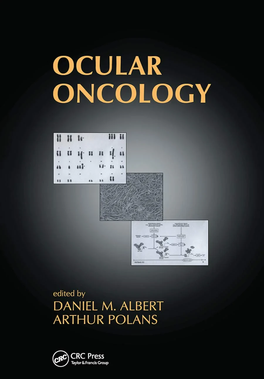 Coperta cărții "Ocular Oncology" de Daniel M. Albert
