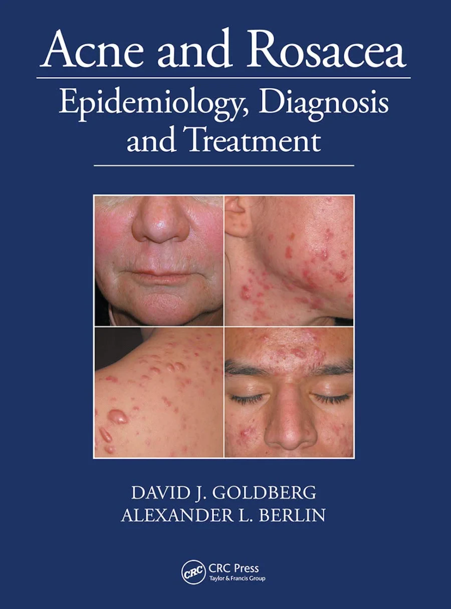 Coperta cărții "Acne and Rosacea: Epidemiology, Diagnosis and Treatment" de David Goldberg, Alexander Berlin