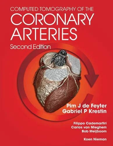 Coperta cărții "Computed Tomography of the Coronary Arteries" de Pim J. de Feyter, G. P. Gabriel Krestin