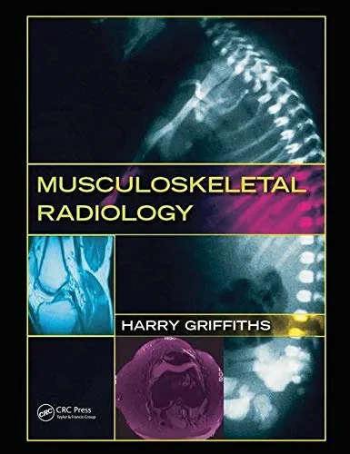 Coperta cărții "Musculoskeletal Radiology" de Harry Griffiths