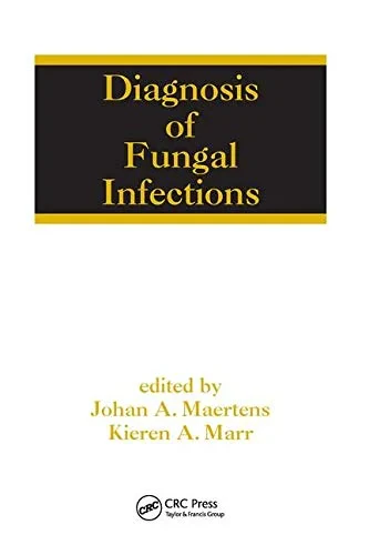 Coperta cărții "Diagnosis of Fungal Infections" de Kieren A. Marr, Johan Maertens