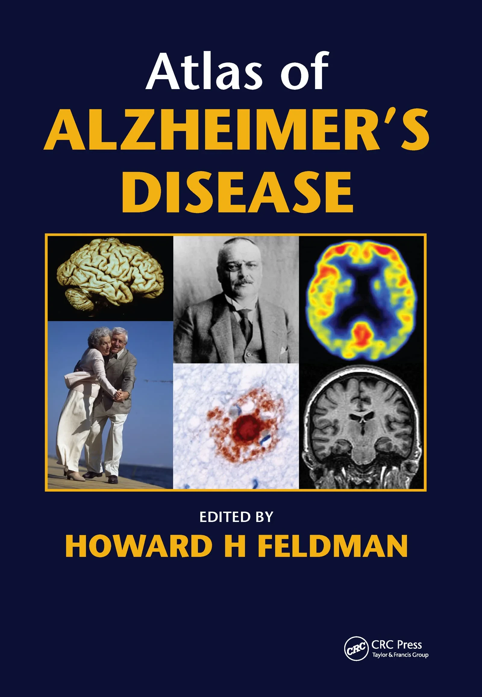 Coperta cărții "Atlas of Alzheimer’s Disease,1st Edition" de Howard Feldman
