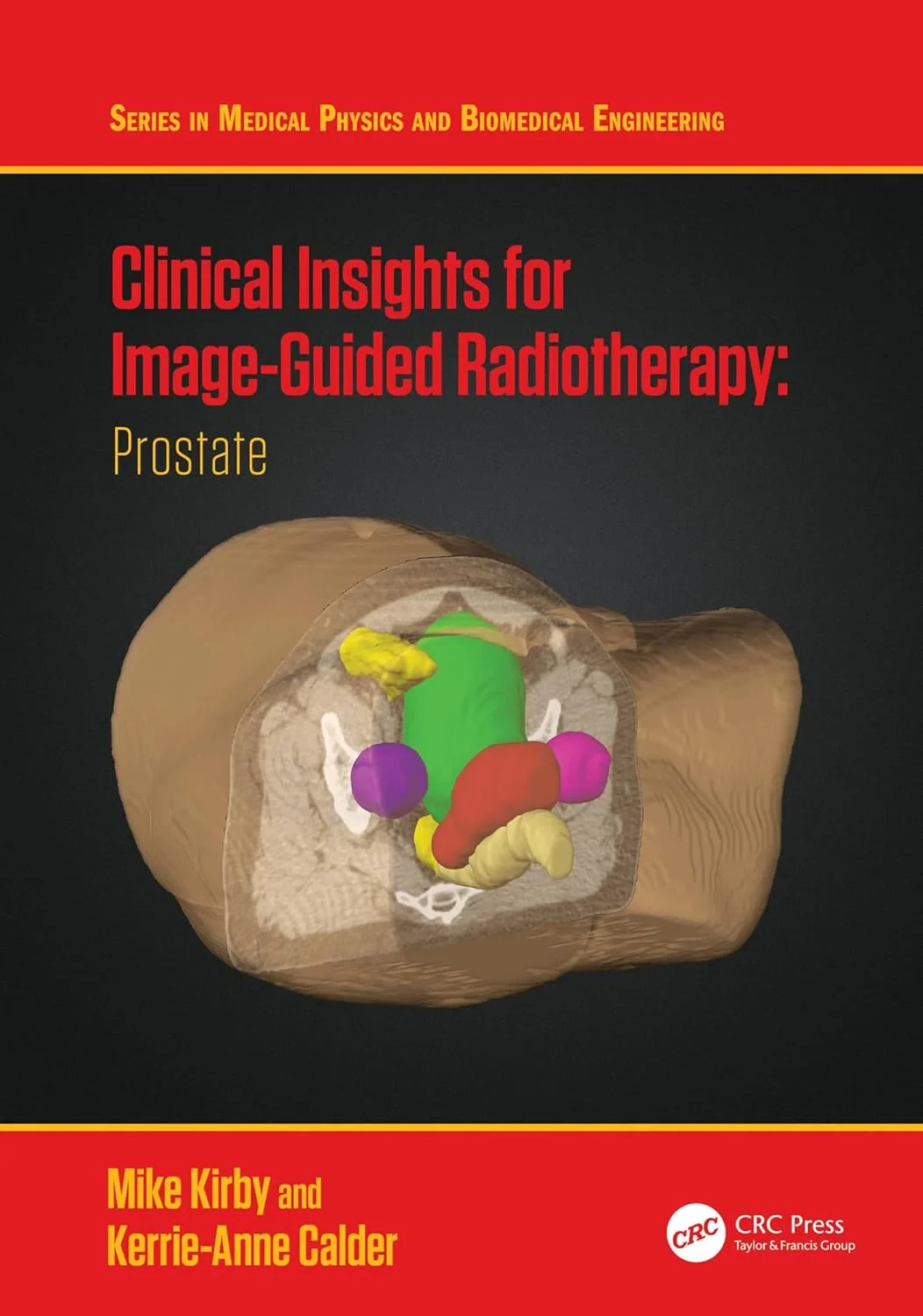 Coperta cărții "Clinical Insights for Image-Guided Radiotherapy: Prostate" de Mike Kirby, Kerrie-Anne Calder