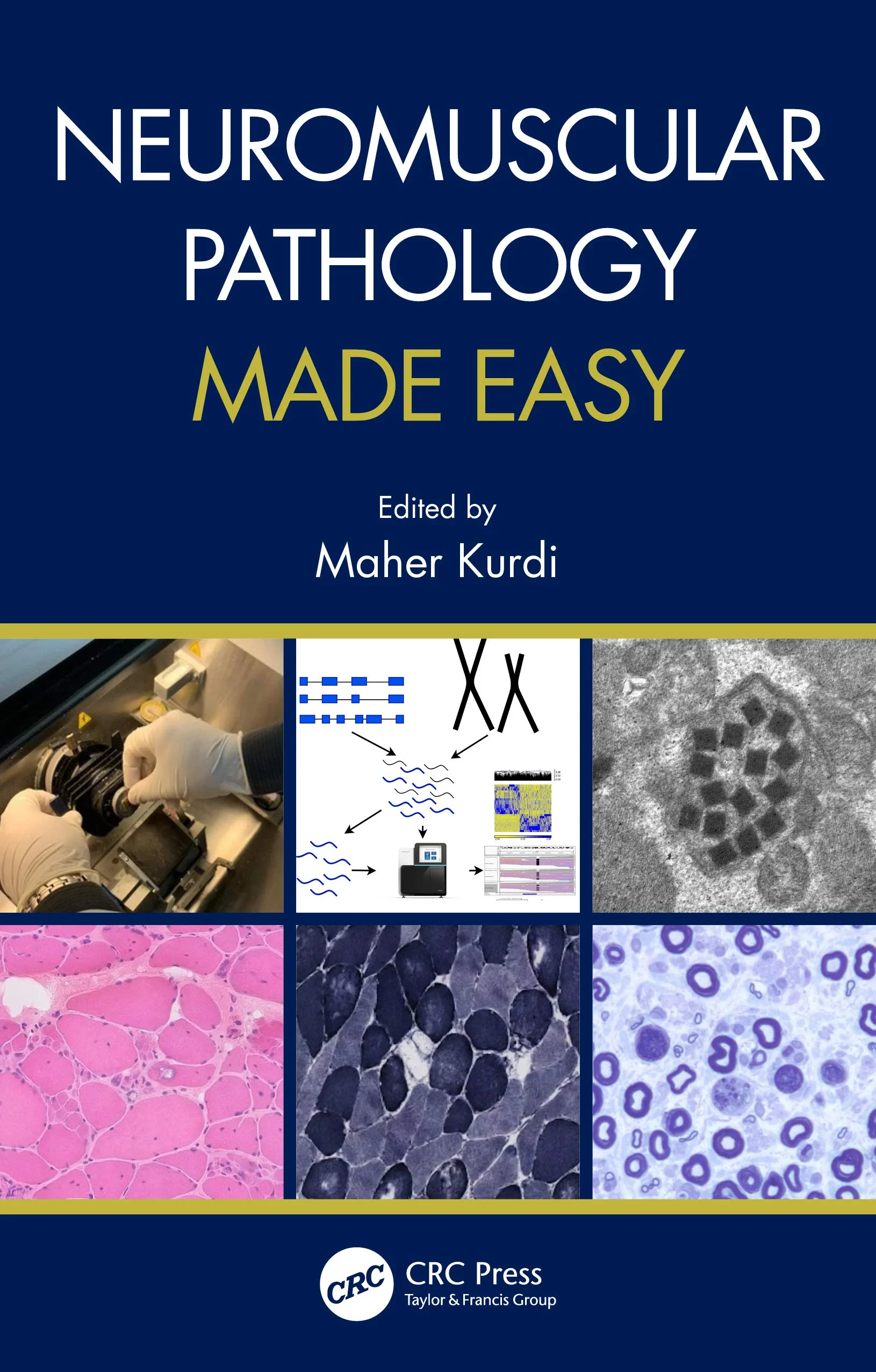 Coperta cărții "Neuromuscular Pathology Made Easy" de Maher Kurdi