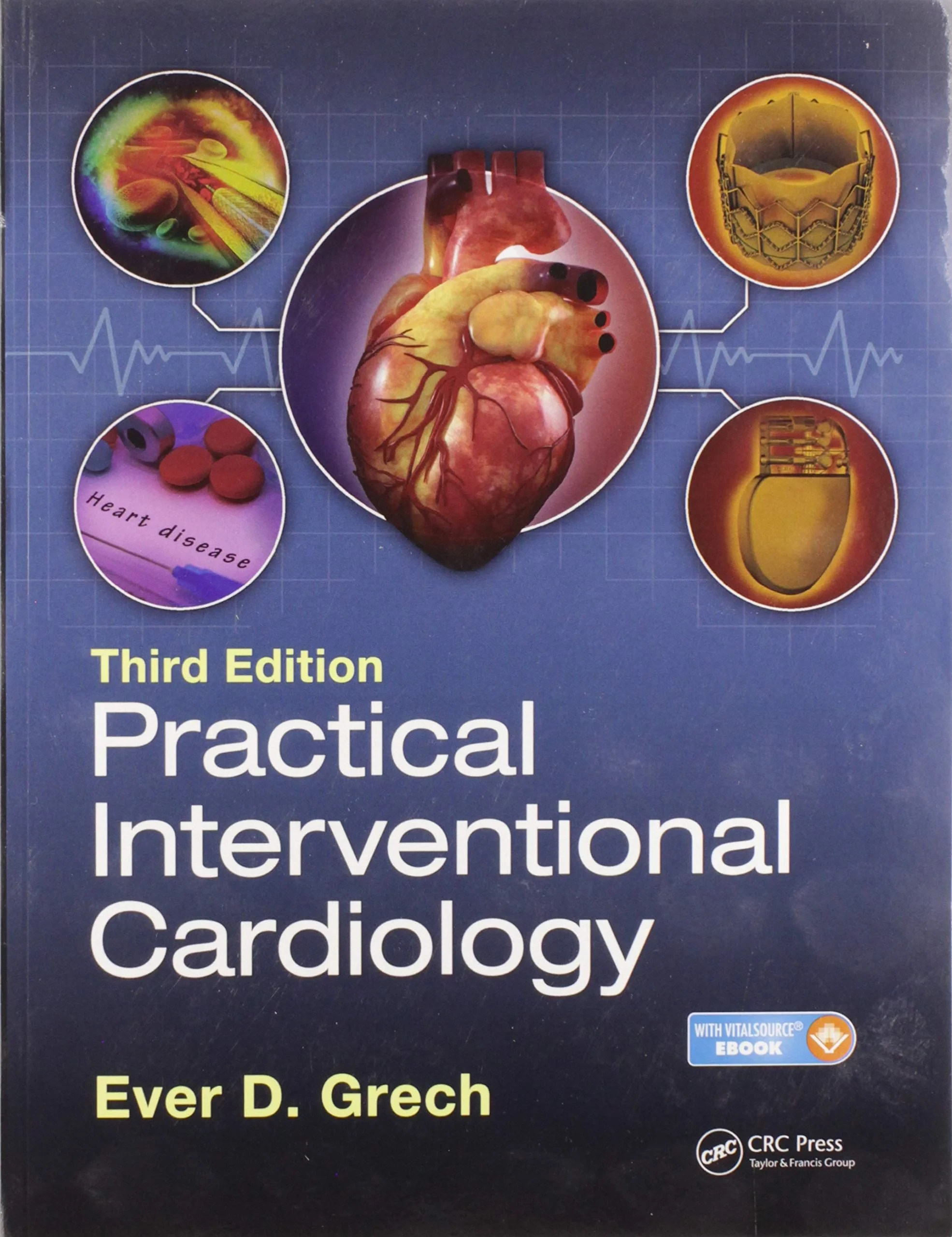 Coperta cărții "Practical Interventional Cardiology: Third Edition" de Ever D. Grech