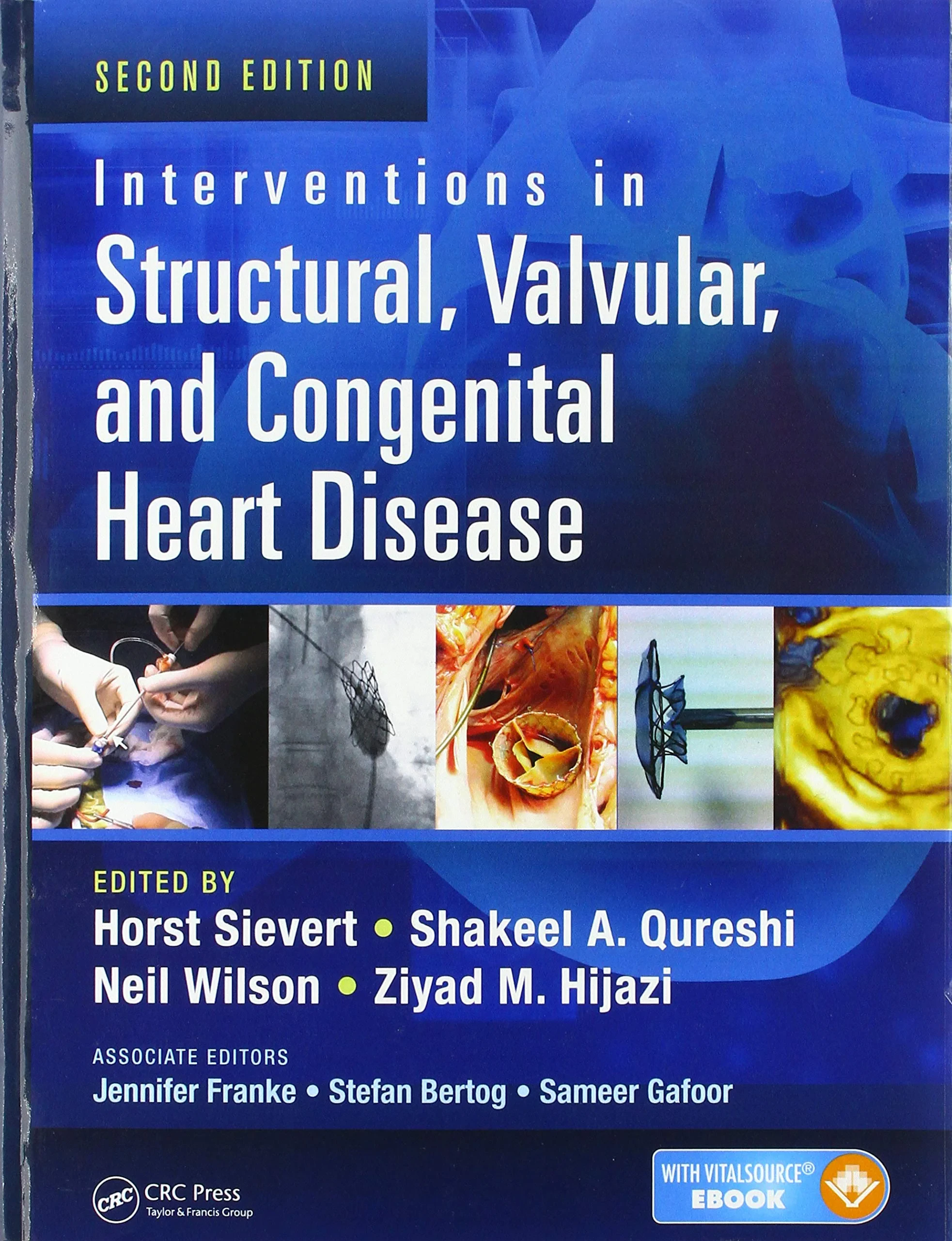 Coperta cărții "Interventions in Structural, Valvular and Congenital Heart Disease" de Neil Wilson, Horst Sievert, Shakeel A. Qureshi, Ziyad M. Hijazi