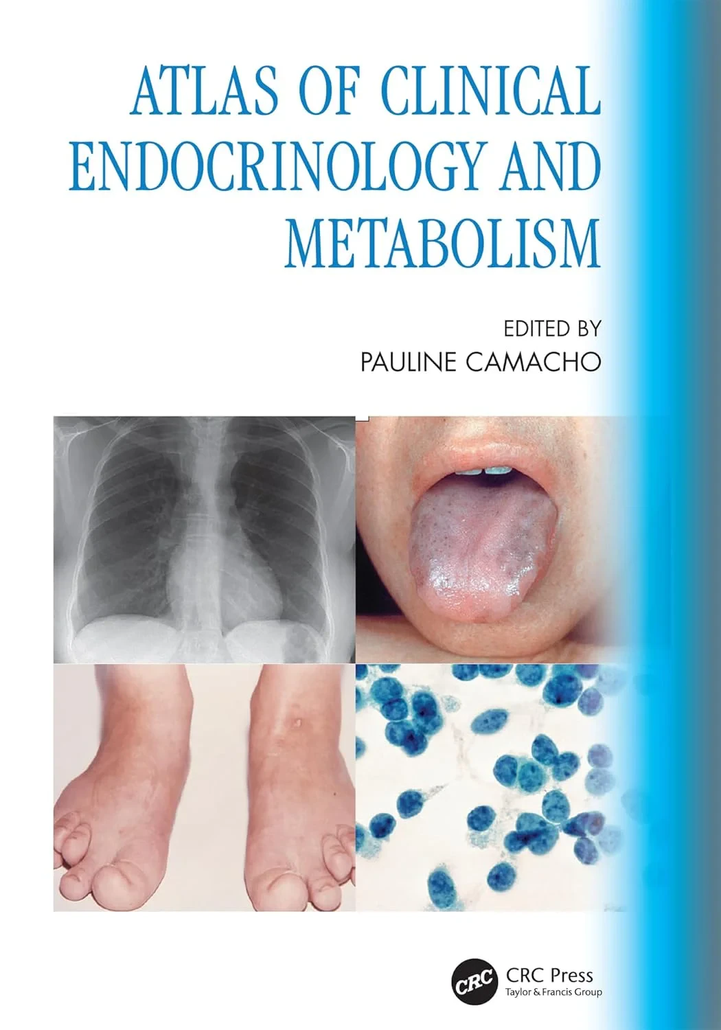 Coperta cărții "Atlas of Clinical Endocrinology and Metabolism" de Pauline Camacho