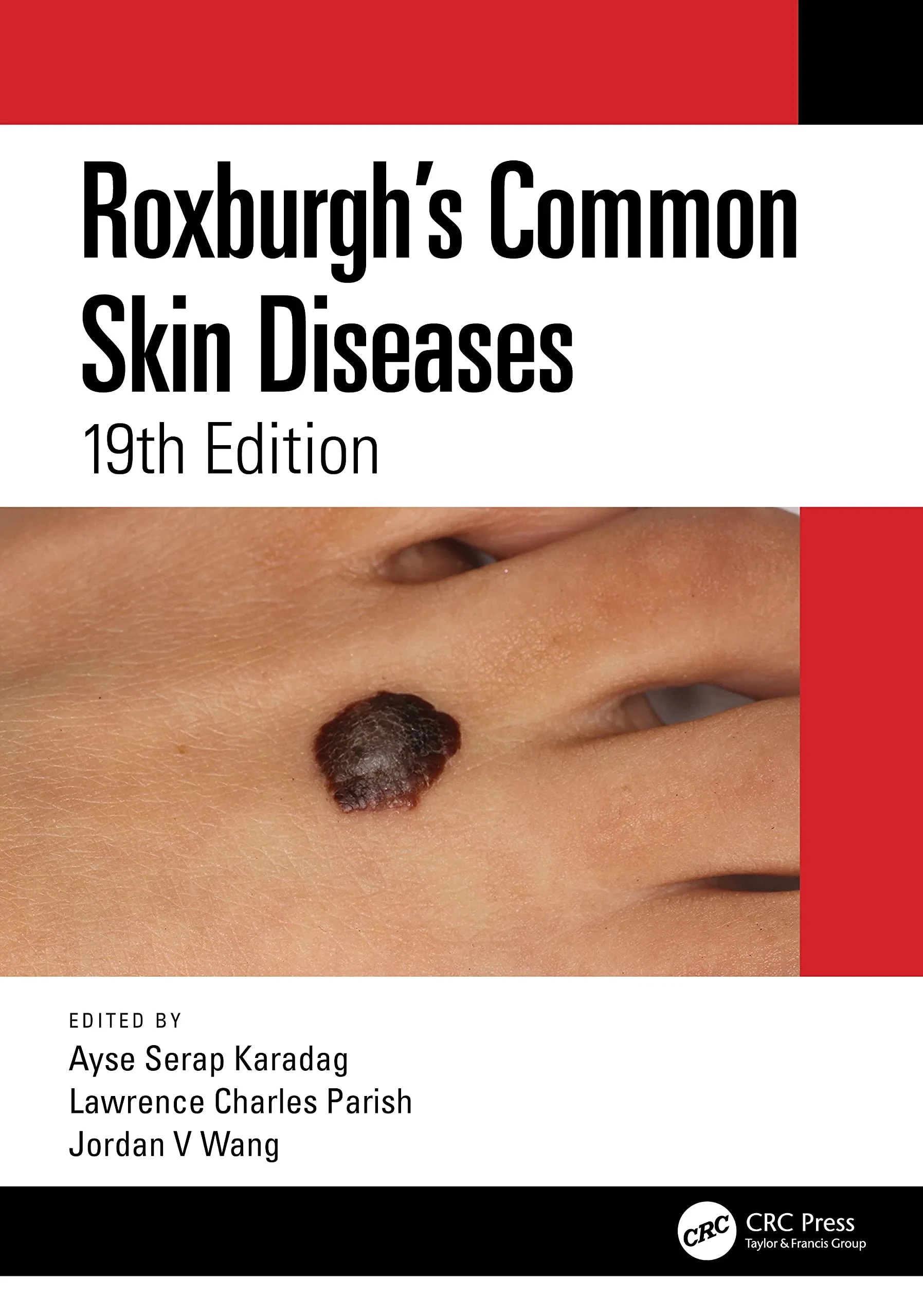 Coperta cărții "Roxburgh’s Common Skin Diseases" de Lawrence Charles Parish, Ayse Serap Karadag, Jordan V. Wang