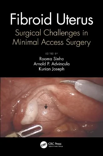 Coperta cărții "Fibroid Uterus: Surgical Challenges in Minimal Access Surgery" de Rooma Sinha, Kurian Joseph, Arnold Advincula