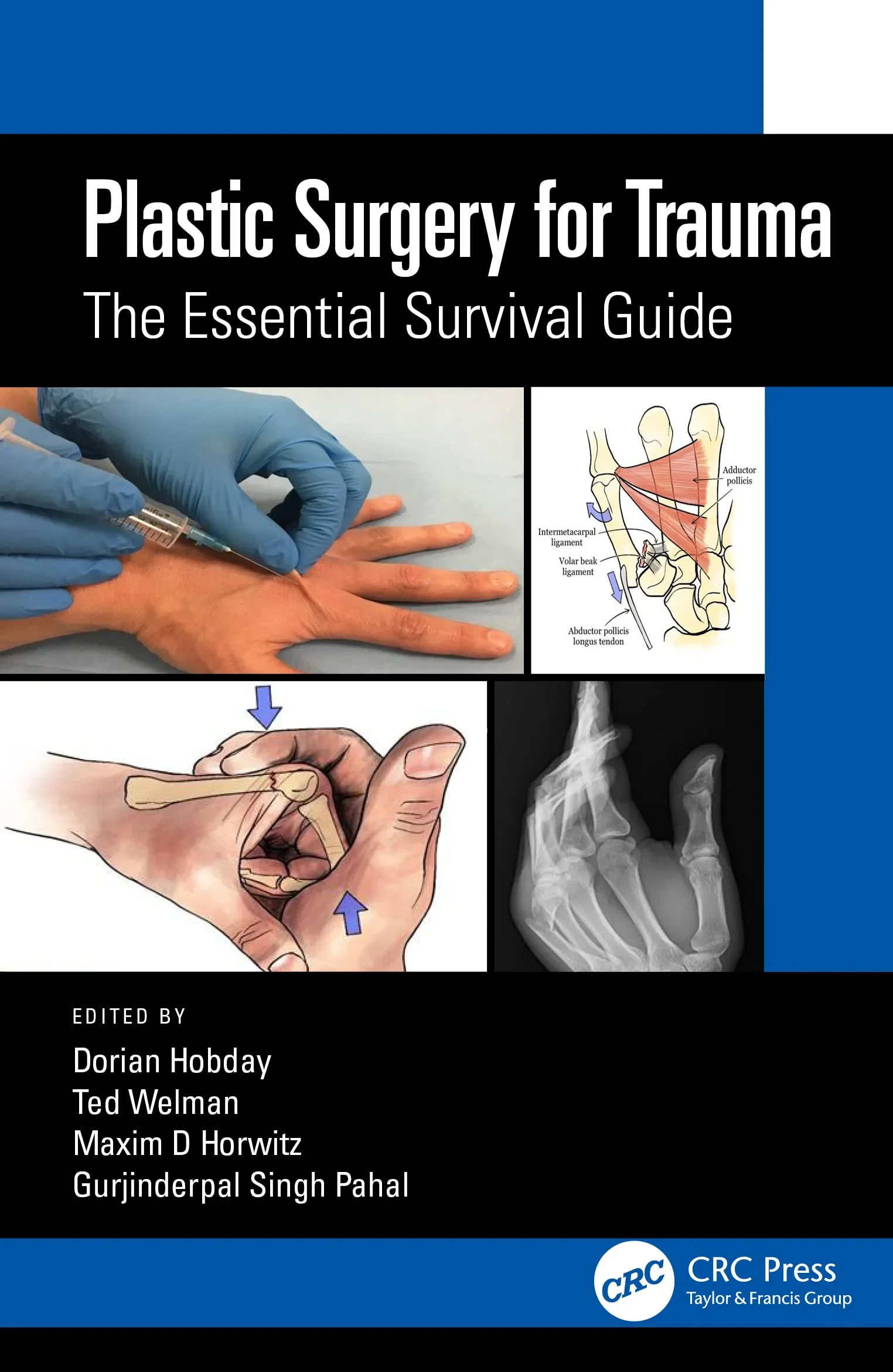 Coperta cărții "Plastic Surgery for Trauma: The Essential Survival Guide" de Dorian Hobday, Ted Welman, Maxim D. Horwitz, Gurjinderpal Singh Pahal