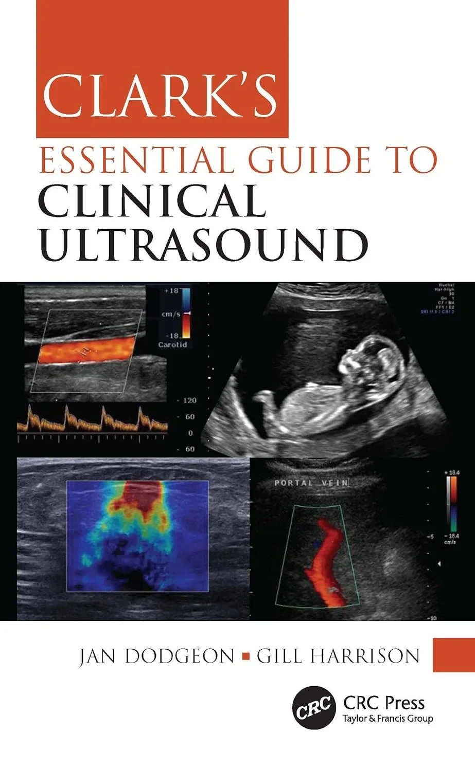 Coperta cărții "Clark’s Essential Guide to Clinical Ultrasound " de Jan Dodgeon, Gill Harrison