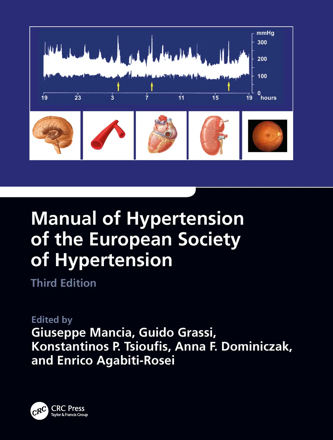 Coperta cărții "Manual of Hypertension of the European Society of Hypertension, Third Edition" de Giuseppe Mancia, Guido Grassi, Konstantinos Tsioufis, Anna Dominiczak, Enrico Agabiti Rosei