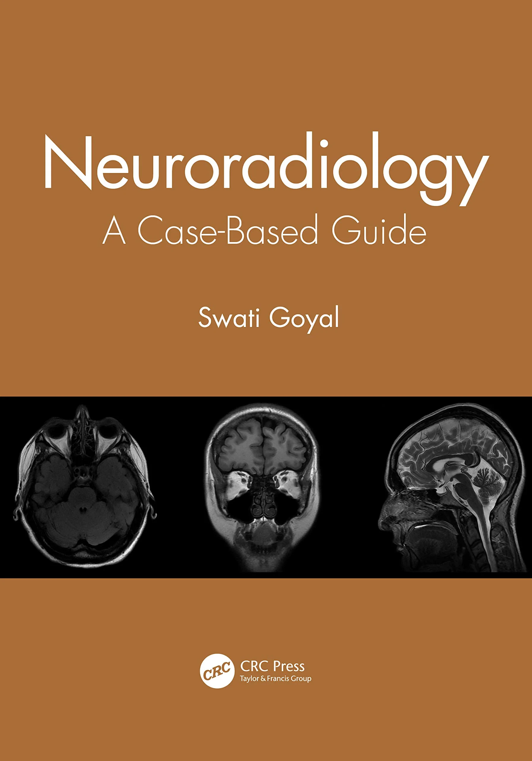 Coperta cărții "Neuroradiology: A Case-Based Guide " de Swati Goyal