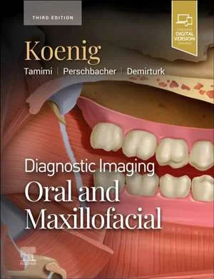 Coperta cărții "Diagnostic Imaging: Oral and Maxillofacial, 3rd Edition" de Lisa J. Koenig, Dania Tamimi, Susanne E. Perschbacher, Husniye Demirturk