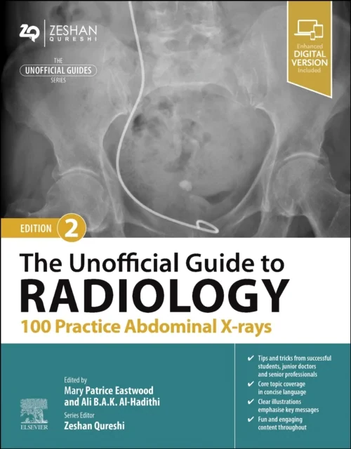 Coperta cărții "The Unofficial Guide to Radiology: 100 Practice Abdominal X-rays " de Zeshan Qureshi, Patrice Eastwood, Ali B.A.K. Al-Hadithi
