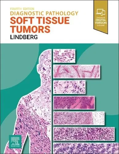 Coperta cărții "Diagnostic Pathology: Soft Tissue Tumors" de Matthew R. Lindberg