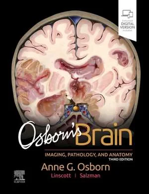 Coperta cărții "Osborn’s Brain, 3rd Edition" de Anne G. Osborn, Gary L. HedlundKaren L. Salzman