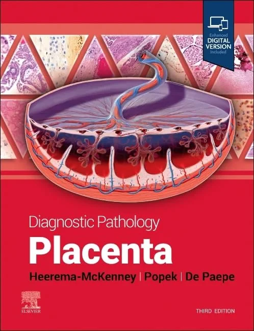 Coperta cărții "Diagnostic Pathology: Placenta, 3e" de Amy Heerema-McKenney, Edwina J. Popek, Monique E. De Paepe