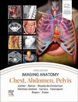 Coperta cărții "Imaging Anatomy: Chest, Abdomen, Pelvis" de Melissa L. Rosado-de-Christenson, Siva P. Raman, Santiago Martinez-Jimenez, Atif Zaheer, Bryan R. Foster, Ghaneh Fananapazir, Sherief H. Garrana, Douglas Rogers