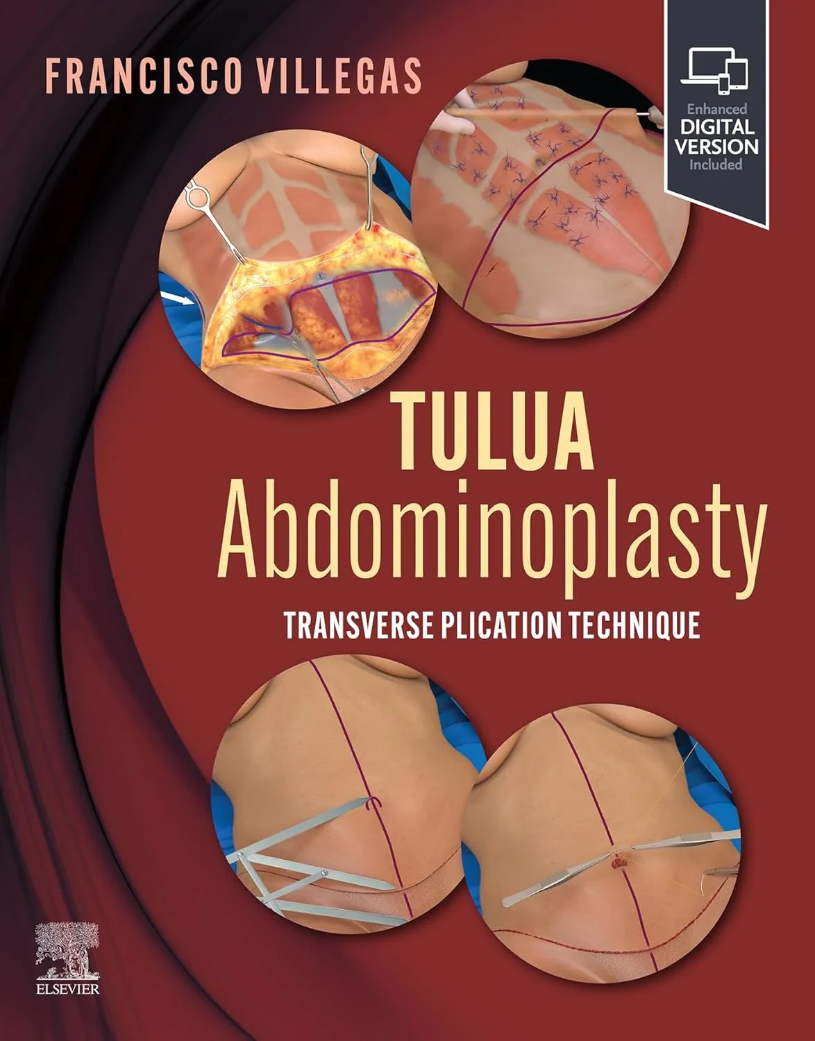 Coperta cărții "TULUA Abdominoplasty: Transverse Plication Technique" de Francisco Javier Villegas-Alza